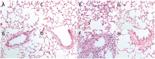 Figure 6. (A–H) Histopathological changes in alveolar (top panel C, E, and G) and bronchial regions (lower panel, D, F, and H) of rats subjected to ammonia (1% NH3) via intratracheal instillation evaluated in comparison to (A,B) healthy controls. Representative sections are shown from (C,D) 5 h, (E,F) 24 h, and (G,H) 14 days and 28 days post-exposure. Sections were stained with hematoxylin-eosin and evaluated with light microscopy using 40× magnification (n = 4 rats per group).