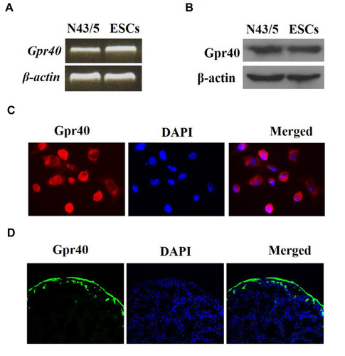 Figure 1 Gpr40 is expressed in mouse epidermal stem cells (ESCs). (A) Expression of Gpr40 at the gene level in mouse ESCs was measured by reverse transcription PCR with murine N43/5 cell line was used as a positive control. (B) Expression of Gpr40 at the protein level in mouse ESCs was measured by Western blot analysis. (C) Immunocytochemical staining of Gpr40 in ESCs. (D) Immunocytochemical staining of Gpr40 in skin tissue.