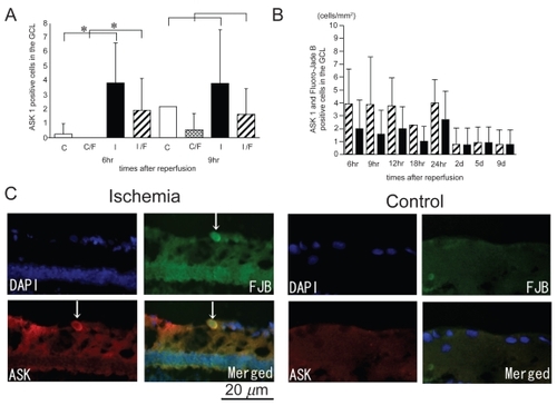 Figure 5 ASK1 expression co-localized with Fluoro-Jade B-positive cells in ischemic retinas and the time course of the number of ASK1-positive cells that are also Fluoro-Jade B-positive. The number of ASK1-positive cells and the number of ASK1 positive cells co-colocalized with Fluoro-Jade B positive signals in the ischemic retinas were significantly increased compared to that of the control retinas only after 6 hours of reperfusion (A). In ischemic retinas, more than one-half of the cells that were ASK1-positive were also Fluoro-Jade B-positive in the GCL (B). The sections were obtained from an ischemic retina 6 hour after reperfusion (C) (multi panel). The expression of ASK1 co-existed with Fluoro-Jade B-positive cells in the GCL (arrows) (C). (A); White bars showed the number of ASK1 positive cells in the control retinas and checked bars showed the number of ASK1 positive and Fluoro-Jade B positive cells in the control retinas. Black bars showed the number of ASK1 positive cells in the ischemic retinas and stripe bars showed ASK1 positive and Fluoro-Jade B positive cells in the ischemic retinas. C, control; I, Ischemia; C/F, Control (ASK1) co-existed with Fluoro-Jade B; I/F, Ischemia (ASK1) co-existed with Fluoro-Jade B.Abbvreviations: h, hours; d, days.