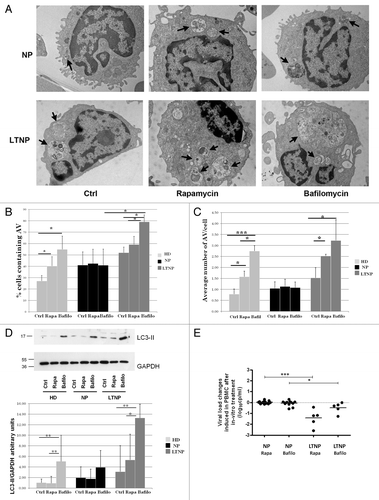 Figure 4. Pharmacological modulation of autophagy. (A) Electron microscopy analysis of PBMC from NP and LTNP treated with the autophagy inducer rapamycin, and the autophagy inhibitor bafilomycin A1. Arrows indicate AV containing undigested material. (B) Electron microscopy quantification of the percentage of cells containing AV in HD, NP, and LTNP. (C) Quantitative analysis of the average number of AV per cell in HD, NP, and LTNP. (D) WB analysis of LC3-II protein. In the graph were reported the mean values of 4 different experiments. (E) Changes in HIV RNA release in culture supernatants of NP and LTNP PBMC, after in vitro treatment with autophagy modulators rapamycin and bafilomycin A1. The difference in HIV RNA concentration between untreated and rapamycin- or bafilomycin A1-treated PBMC was calculated for each sample and reported in the figure. Original magnification: (A) 12.000×. *P < 0.05, **P < 0.01, ***P < 0.001.