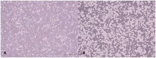 Figure 3. Colo-320 and Colo-741 cells imaged under an inverted microscope: (A) Colo-741 cells and (B) Colo-320 cells. Scale bars = 500 μm.