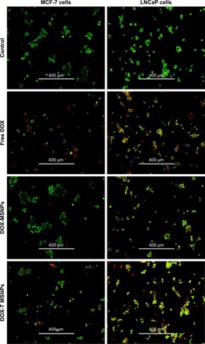 Figure 5 AO/EB dual staining in MCF-7 and LNCaP cells after treatment with free DOX, DOX-loaded bare MSNPs (DOX-MSNPs), and DOX-loaded targeted MSNPs (DOX-T MSNPs).Abbreviations: AO, acridine orange; DOX, doxorubicin; EB, ethidium bromide; MSNPs, mesoporous silica nanoparticles.