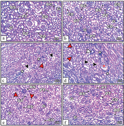 Figure 5. Kidney histological images from the control (a), AE (b), STZ (c–d), and STZ+AE (e–f) groups of rats. In STZ-induced diabetic rats, the sections showing atretic or lytic (read arrow heads), hypertrophied (red star), damaged tubular epithelial cells with relatively wide lumens (black arrow heads), thickened wall capillaries (white arrow heads), and scattered infiltrated cells (white asterisks). In the diabetic and AE groups, the glomerular and tubular architectures show remarkable amelioration. Abbreviations: BC: Bowman’s capsule; BS: Bowman’s space; CD: collecting duct; G: glomerulus; DT: distal tubule; and PT: proximal tubule. (Stain: H&E, scale bar: 100µm).