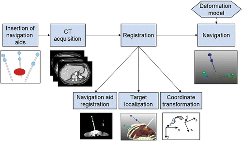 Figure 1. Soft tissue navigation workflow. [Color version available online.]