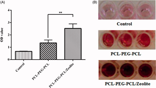 Figure 4. (A) hDPSCs osteogenic differentiation on TCPs (control), PCL-PEG-PCL, and PCL-PEG-PCL/Zeolite scaffolds after 21 days of cell seeding. **p < .01; (B) hDPSCs were stained with Alizarin red S staining at 21th day to envisage mineralized bone matrix.