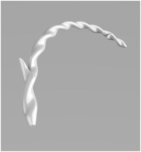 Figure 1. Archimedes stent (amg International GmbH, Winsen, Germany) has a helical structure allowing the bile flow on the outer extremity of the stent while supporting the opening of the lumen. The stent has anatomical shape, tapered tip, and proximal and distal flaps.