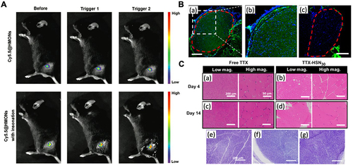 Figure 4 In vivo imaging of inorganic nanoparticles for local anesthetic delivery. (A) In vivo fluorescence imaging of cy5.5@HMONs with or without two cycles of ultrasound irradiation around the sciatic nerve. Reproduced with permission from Gao X, Zhu P, Yu L, Yang L, Chen Y. Ultrasound/acidity-triggered and nanoparticle-enabled analgesia. Adv Healthc Mater. 2019;8(9):e1801350. Copyright © 2019, WILEY‐VCH Verlag GmbH & Co. KGaA, Weinheim.Citation46 (B) Representative fluorescence images of sciatic nerves and surrounding tissues 4 h after injection of FITC-SN10 (~10 nm) (a, b) and FITC-SN70 (~70 nm) (c). The red dotted line indicates the nerve perimeter. Scale bars, 200 μm. (C) Histology of rat tissues injected with free TTX and TTX-HSN30. Mild myotoxicity and inflammation was observed at 4 and 14 days after injection in animals administrated with free TTX and TTX-HSN30. (a−d) Representative H&E stained sections of muscles at the site of injection 4 and 14 days after injection. Scale bars, 200 μm (left), 50 μm (right). (e−g) Representative toluidine blue-stained sections of sciatic nerves from animals without (e) and with (f and g) injection of TTX-HSN30. Harvested 4 days after injection (f) and 14 days after injection (g). Scale bars, 100 μm. Reprinted with permission from Liu Q, Santamaria CM, Wei T, et al. Hollow silica nanoparticles penetrate the peripheral nerve and enhance the nerve blockade from tetrodotoxin. Nano Lett. 2018;18(1):32–37. Copyright © 2018, American Chemical Society.Citation47