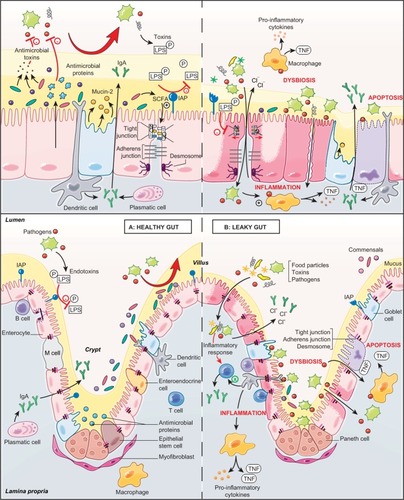 Figure 1 Role of the intestinal barrier components in a healthy gut and a leaky gut.