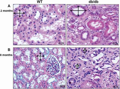 Figure 1. Hypertrophy and atrophy during different stages of diabetes. (A) H&E staining of kidney section showed increase in the proximal tubular cells size as well as basement membrane thickness in 2 months old of diabetic mice (db/db) compared to kidney from wild type (WT) mice. (B) On the other hand, decrease in proximal tubular cells size showed in kidney of 8 months old of diabetic mice (db/db) compared to WT mice at the same age. Double arrowheads marked the size of proximal tubular cells in kidney of WT and diabetic mice (db/db). Photographs were taken under same magnification (40X).