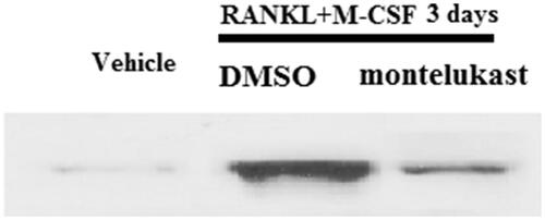 Figure 7. Montelukast inhibited interaction between TRAF6 and RANK. Mouse BMMs were incubated in serum-free medium for 5 h and pretreated with vehicle or montelukast (10 µM) for 2 h, followed by incubation with 50 ng/ml RANKL and 20 ng/ml M-CSF for 6 h. Representative images for co-immunoprecipitation of TRAF6 and RANK (*, #, p < .01 vs. previous column group).