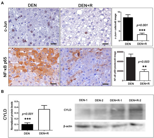 Figure 3 Effects of HDAC1/2 depletion on the expression of selected cell-stress-associated proteins. (A) HCC cells show significantly decreased cytoplasmic NF-κB and nuclear c-Jun expression after treatment with Romidepsin. (B) The treatment also caused an increase of the expression of the NF-κB suppressor protein CYLD, as assessed by Western Blot analysis. Shown are bands from liver tissue of two selected representative mice per group. IHC; Diaminobenzidine chromogen, Hematoxylin counterstain. Scale bars: 25 μm. Numbers on the y-axis of bar graphs correspond to the mean±SEM of the parameters assessed. **p<0.01, ***p<0.001.Abbreviations: c-Jun, jun proto-oncogene; CYLD, CYLD lysine 63 deubiquitinase; DEN, diethylnitrosamine; NF-κB p65, nuclear factor of kappa light chain enhancer of activated B cells, p65; R, Romidepsin.