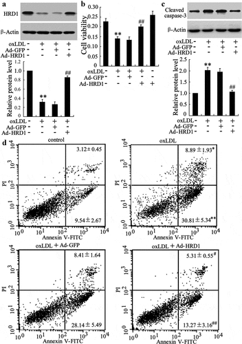 Figure 2. Ox-LDL-induced apoptosis of endothelial cells can be attenuated by HRD1 overexpression. HUVECs were transfected with Ad-GFP or Ad-HRD1 for 24 h, followed by exposure to ox-LDL (80 μg/ml) for 48 h. HRD1 expression (a), cell viability (b), cleaved caspase-3 levels (c) and HUVEC apoptosis (d) were then measured. Values are means ± SD and are representative of three individual experiments. *P < 0.05 and **P < 0.01, compared to control. #P < 0.05 and ##P < 0.01, compared to ox-LDL + Ad-GFP.