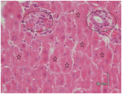 Figure 6. Paraffin sections stained by haematoxylin and eosin (H&E) for histopathological examination of liver tissues of rats treated with APAP (500 mg/kg) and RA (10 mg/kg). There are still some regions of injury induced by APAP. Circles show inflammatory cell infiltrations and asterisks indicate hepatic cell necrosis.