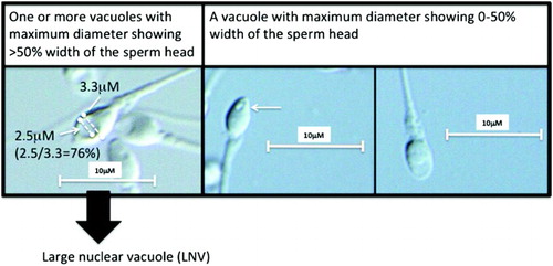 Figure 1.  High magnification by an inverted microscope equipped with Nomarski differential interference contrast optics and video system. Arrows indicate nuclear vacuoles observed through a 100x (1.40 numerical aperture) objective lens. Dotted lines indicate the width of the sperm head (3.3 µM) and the maximum diameter of a nuclear vacuole (2.5 µM).