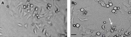 Figure 1 Morphology of L929 cells.Notes: (A) Control. (B) At 50 μg/mL of Cr2O3NPs for 24 hours. Scale bar (▬) is 50 μm; magnification 40×. The arrow indicates a damaged cell.Abbreviation: Cr2O3NPs, chromium oxide nanoparticles.