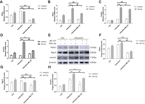 Figure 4 (A-D) ML141 suppresses the mRNA expression of PDX1, Ngn3, Insulin and GLUT2. qPCR detected the mRNA expression of (A) PDX1, (B) Ngn3, (C) Insulin and (D) GLUT2 in IPCs. (E-H) ML141 suppresses protein expression of PDX1, Ngn3 and Insulin. Western blot measured the protein expression of (F) PDX1, (G) Ngn3 and (H) Insulin in IPCs. Data were shown as the mean ± SD, n = 3. Values were significantly different compared with the corresponding control value at *p<0.05, **p<0.01, #p<0.05 and ##p<0.01.