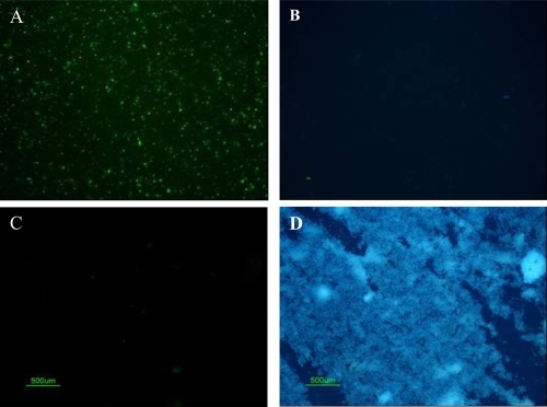 Figure 4 Light microscopic images of double staining results of patient samples cultured under CNP culture conditions. (A) IIFS of cultured patient samples showed positive fluorescence signal using monoclonal antibody 8D10 when imaged with the green bandpass emission filter, (B) Negative results of Hoechst dye of sample A imaged with the blue bandpass emission filter. (C) IIFS of negative bacterial control (nonpathogenic E. coli strain HB101) showed no fluorescence signal using CNP-specific monoclonal antibody when imaged with green bandpass emission filter. (D) Positive results of Hoechst dye of sample C imaged with the blue bandpass emission filter.