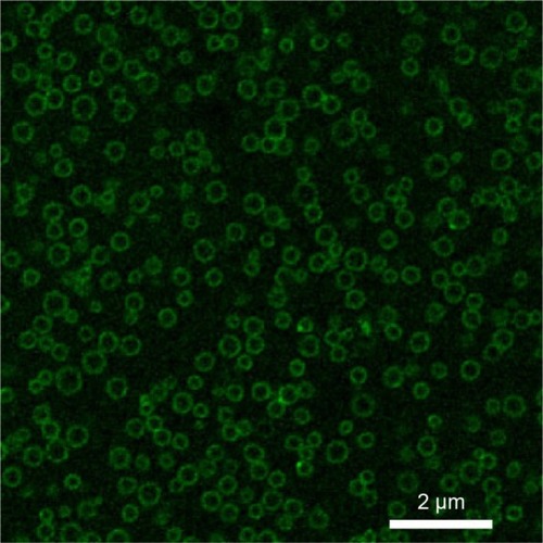 Figure 4 Laser scanning confocal microscopic image of the Fe3O4-PLGA-cRGD NPs.Note: Annular green fluorescence was observed around NPs, but almost no fluorescence was detected in the inner aqueous phase.Abbreviations: cRGD, cyclic Arg-Gly-Asp; NPs, nanoparticles; PLGA, poly(lactic-co-glycolic acid).