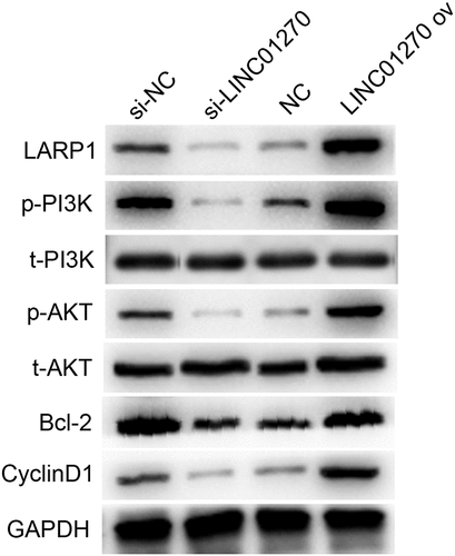 Figure 9. Western blot results demonstrated up-regulation of LARP1, p-PI3K, p-AKT, Bcl-2, and CyclinD1 in the LINC01270 overexpression group, while the proteins were down-regulated in the si-LINC01270 group.