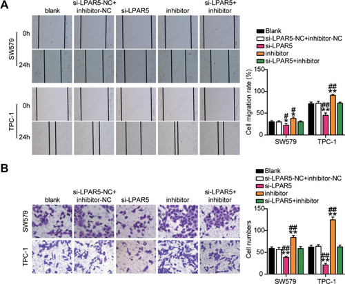 Figure 9 MiR-513c-5p inhibits migration and invasion of THCA cells through LPAR5. (A) Migration of SW579 and TPC-1 cells with si-LPARS or miR-513c-5p inhibitor transfection were detected by wound healing assay. (B) Invasion of SW579 and TPC-1 cells with si-LPARS or miR-513c-5p inhibitor transfection were detected by transwell assay. si-LPARS, silencing LPARS. Inhibitor, miR-513c-5p inhibitor. NC, co-transfected with si-LPARS-NC and inhibitor-NC. *P < 0.05, **P < 0.001 vs blank; #P < 0.05, ## P < 0.001 vs si-LPAR5+inhibitor.