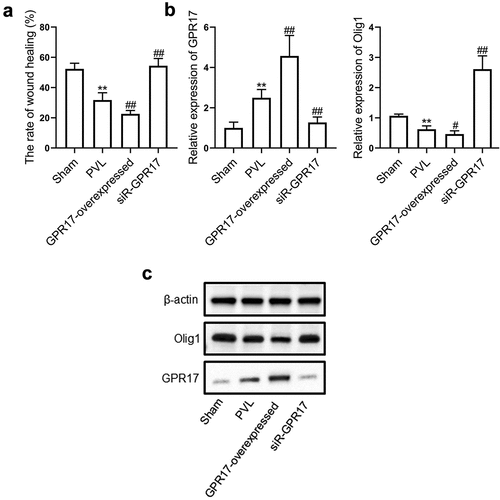 Figure 4. GPR17 suppressed the migration of OPCs by downregulating Olig1. a. Their migration ability was evaluated by a wound healing assay. b. The gene expression levels of GPR17 and Olig1 were determined by RT-PCR. c. The protein expression levels of GPR17 and Olig1 were measured by Western blotting (**p < 0.01 vs. sham, #p < 0.05 vs. PVL, ##p < 0.01 vs. PVL)