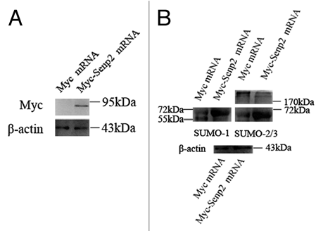 Figure 4 Overexpression of Senp2 resulted in changes of SUMO modified proteins. (A) Myc-Senp2 protein was expressed in mouse oocytes. Myc-Senp2 mRNA microinjected GV oocytes were incubated in M16 medium containing 2.5 µM milrinone for 5 h and collected immediately; the lysates were then analyzed by immunoblot with mouse monoclonal anti-myc antibody. Equal numbers of oocytes microinjected with Myc mRNA was analyzed as a control. (B) Germinal vesicle oocytes were microinjected with the control Myc mRNA and Myc-Senp2 mRNA, respectively. After microinjection, oocytes were incubated in M16 medium with 2.5 µM milrinone for 5 h, then transferred to milrinone-free M16 medium for 10 h and collected, followed by immunoblot analysis with SUMO-1 or SUMO-2/3 specific mouse monoclonal antibodies. Three independent experiments were performed.