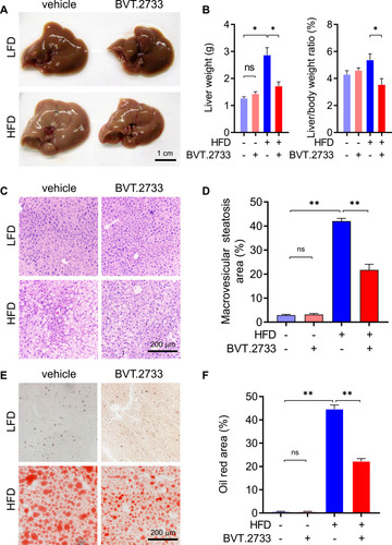 Figure 3 BVT.2733 attenuates hepatic steatosis in diet-induced NAFLD mice. (A and B) The morphology of liver (A) and weight of liver (B) in vehicle or BVT.2733 (50 mg/kg/day) groups of mice fed with either LFD or HFD. Data are presented as the means ± sem; *P < 0.05 by unpaired t-test with Welch’s correction, n=4–5. (C–F) H&E staining (C) and Oil-red O staining (E) of liver sections in the vehicle or BVT.2733 (50 mg/kg/day) group of mice fed with either LFD or HFD. Bars=200 μm. Quantification of macrovesicular steatosis area (D) and Oil-red O positive area (F) of liver sections. Data are presented as the means ± sem, n=8. *P < 0.05; **P < 0.01; by unpaired t-test with Welch’s correction.