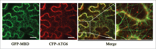 Figure 2. ATG6 colocalizes with microtubules in vivo. Images were taken when CFP-ATG6 and the microtubule reporter, GFP-MBD, were transiently coexpressed in N. benthamiana leaves for 48 h. GFP-MBD-labeled microtubules appear green and CFP-ATG6-labeled punctate structures are pseudocolored red. Scale bars: 20 μm.
