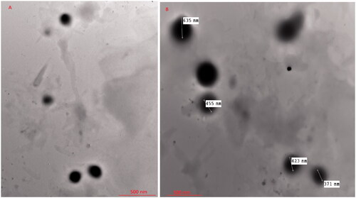 Figure 4. TEM micrographs of the optimized VCZ loaded MLNCs formulation.