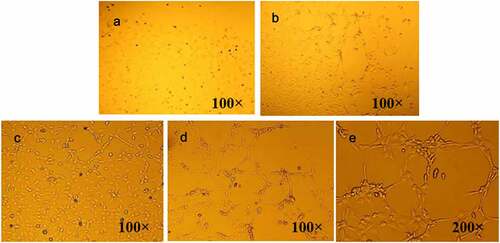 Figure 2. Observation of cell morphology under microscope. (a) preliminarily isolated mononuclear cell; (b) EPCs cell after three days of culture; (c) EPCs cells cultured for five days; (d) EPCs cells cultured for eight days (100×); (e) EPCs cells cultured for eight days (200×).