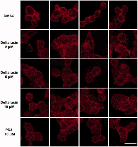 Figure 6. Immunofluorescence of PANC-1 cells with an anti-Pan-RAS antibody (red). DMSO was used as a negative control, and deltarasin was used as a positive control. Ex: 633 nm, Em: ≥638 nm. The scale bar represents 20 µm.