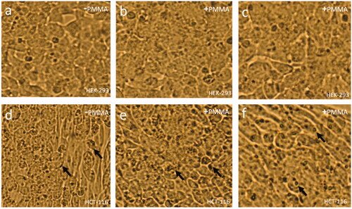 Figure 5. Cell Morphology of HEK-293 and HCT-116 cells after 48 h of treatment of PMMA: (a) control, (b) 5.0 μg/mL and (c) 7.5 μg/mL of HEK-293 cells. (d) Control, (e) 5.0 μg/mL and (f) 7.5 μg/mL of HEK-293 cells. Nuclear condensation (arrows). (400× magnifications).