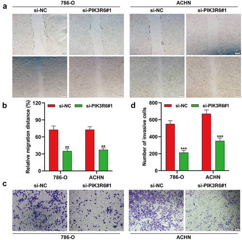 Figure 5. PIK3R6 silencing inhibited the migratory and invasive ability of CCRCC cells. 786–O and ACHN cells were transfected with si-PIK3R6#1 or si–NC for 48 h. (a–b) Cell migration was determined in transfected 786-O and ACHN cells by wound healing assay. (c–d) Cell invasion was determined in transfected 786-O and ACHN cells by transwell invasion assay. The data were shown as the mean ± SD. **p < .01, ***p < .001, compared with si-NC.