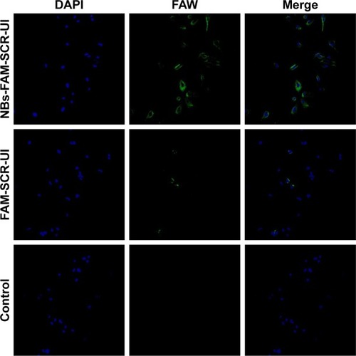 Figure 5 Laser confocal microscopic images of U87 cells of NBs-FAM-SCR-UI group and FAM-SCR-UI group. Much more green fluorescence of FAM-SCR was observed in the NBs-FAM-SCR-UI group.