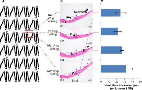 Figure 5 Neointima thicknesses at the struts, with or without the drug coating, of the iliac artery implanted with a sirolimus AGC stent for 2 weeks.