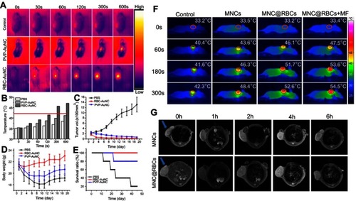 Figure 3 (A) Thermographs of mice injected with the RBC-AuNPs and the pristine PVP-AuNPs after 48 hours. The mice were irradiated with an 850 nm laser (1 W/cm2). (B) Tumor site temperature based on thermographs of mice in (A). Red line indicates the lowest cancerous cells ablation temperature –42°C. (C) Graphs of the average tumor volume. (D) Graphs of the average mouse body weight. (E) Graphs of the mouse survival ratio. (F) Thermographs of tumor-bearing mice under an 808 nm NIR laser exposure (5 W/cm2) for 0–300 seconds. (G) After intravenous injection with MNCs and MNC@RBCs, T2-weighted MR images of tumor-bearing mice were taken at different time points. Blue arrows indicate the tumor locations. Citation41,Citation53 Reprinted from Biomaterials, 92, Ren X, Zheng R, Fang X, et al. Red blood cell membrane camouflaged magnetic nanoclusters for imaging-guided photothermal therapy. 13–24, Copyright (2016), with permission from Elsevier.Citation41 Reprinted with permission from Piao J-G, Wang L, Gao F, You Y-Z, Xiong Y, Yang L. Erythrocyte membrane is an alternative coating to polyethylene glycol for prolonging the circulation lifetime of gold nanocages for photothermal therapy. ACS Nano. 2014;8(10):10414–10425. doi:10.1021/nn503779d. Copyright 2014 American Chemical Society.Citation53Notes: Fig 3 parts F, G is taken from reference 41, parts A-E is taken from reference 53.Abbreviations: MNCs, iron oxide magnetic nanoclusters; MNC@RBCs, RBC membrane camouflaged iron oxide magnetic clusters; MF, magnetic field.