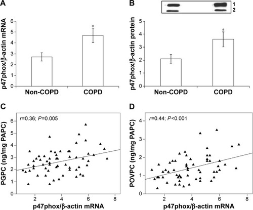 Figure 5 p47phox mRNA and protein expression in PBMC of non-COPD and COPD and correlations between p47phox mRNA expression and PGPC and POVPC concentrations in PBMC of all subjects.Notes: (A) mRNA expression of p47phox. mRNA was analyzed by quantitative real-time PCR; normalized gene expression levels are given as the ratio between the mean value for the target gene and β-actin in each sample. Data are expressed as mean ± SD. *P<0.001 versus non-COPD. (B) Representative Western blot analysis for p47phox protein and the average quantification obtained by densitometric analysis of all the samples derived from non-COPD and COPD subjects. Data are expressed as mean ± SD; *P<0.001 versus non-COPD. (C) Correlation between p47phox mRNA expression and PGPC concentrations in PBMC of all non-COPD and COPD subjects. (D) Correlation between p47phox mRNA expression and POVPC concentrations in PBMC of all non-COPD and COPD subjects.Abbreviations: COPD, chronic obstructive pulmonary disease; mRNA, messenger RNA; PAPC, 1-palmitoyl-2-arachidonyl-sn-glycero-3-phosphorylcholine; PBMC, peripheral blood mononuclear cells; PGPC, 1-palmitoyl-2-glutaroyl-sn-glycero-3-phosphorylcholine; POVPC, 1-palmitoyl-2-(5-oxovaleroyl)-sn-glycero-3-phosphorylcholine; SD, standard deviation.