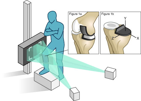 Figure 1. An overview of the dynamic RSA set-up for the step-cycle motion (with the patient standing in the initial unloaded starting position for the step-up motion). a. The orientation of the Oxford UKA. b. The component-specific reference axis of the tibial component used for the RSA analysis.