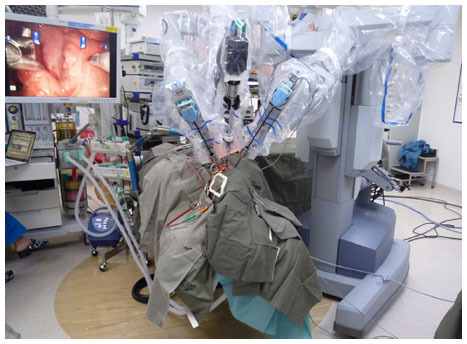 Figure 1 View of the setup of the patient and the da Vinci surgical robot for robotic radical tonsillectomy.