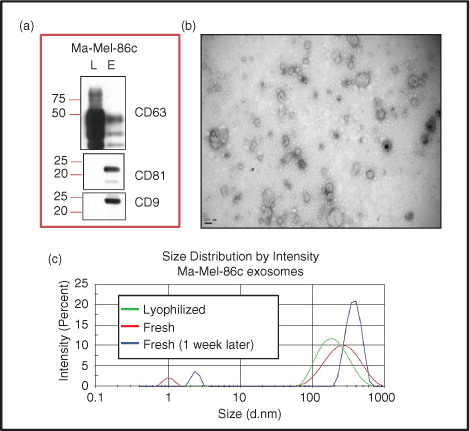 Fig. 2.  Metastatic melanoma exosome characterization. (a) Western blot: Ma-Mel-86c lysates (L) and exosomes (E) were prepared, run in SDS-PAGE and analysed by western blot using the indicated antibodies. (b) TEM image: Exosomes from Ma-Mel-86c cells were negatively stained with 2% phosphotungstic acid and analysed by electron microscopy. Bar: 100 nm. (c) Hydrodynamic size distribution profiles: Lyophilized and fresh Ma-Mel-86c-derived exosomes (as indicated) were analysed in a Zetasizer for their size distribution. The graph shows 1 reading representative of 3.
