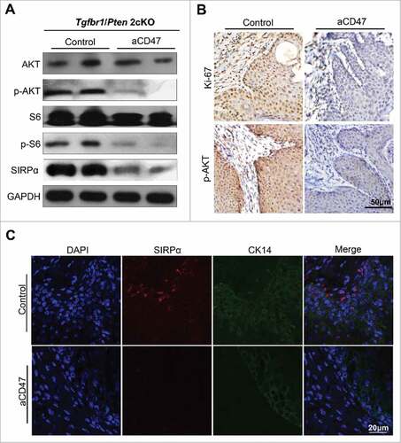 Figure 7. Anti-CD47 treatment influenced proliferation and may influence Akt-dependent pathway. (A) Western blot for AKT, p-AKT, S6, p-S6 and SIRPα in aCD47 group and isotype control group with GAPDH as a loading control. (B) Representative immunohistochemical staining of Ki-67 and p-AKT and (C) immunofluorescence staining of SIRPα in aCD47 group and isotype control group.