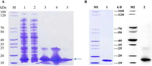 Figure 8. Expression, purification, and verification of SeCystatin. (A) Expression and purification results of SeCystatin analyzed by SDS-PAGE. Lane M: SDS-PAGE protein marker (cat. no. MY1397, MerryBio, Nanjing, China). Lane1: Supernatant after centrifugation of whole bacteria. Lane 2: Supernatant after incubation with Ni-IDA for 90 min. Lanes 3–4: Elution fraction of 50 mmol/L imidazole. Lane 5: Elution fraction of 300 mmol/L imidazole. (B) Quality and specificity of SeCystatin were verified by SDS-PAGE and Western blot analysis. Lane 1-2: Purified SeCystatin. M1: SDS-PAGE protein marker (cat. no. MY1397, MerryBio, Nanjing, China). M2: Western blot marker (cat. no. MY00521, MerryBio, Nanjing, China).