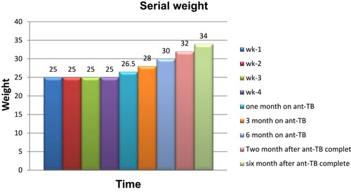 Figure 3 Serial weight measurement during a hospital stay and on follow up after anti-TB treatment began.