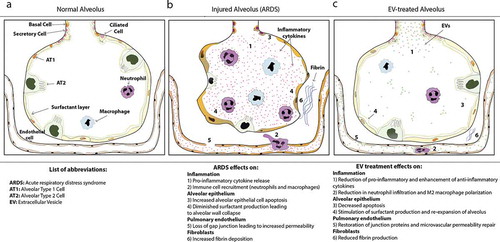 Figure 1. Restorative effects of extracellular vesicle (EV) therapies in acute respiratory distress syndrome (ARDS). Compared to the normal alveolus (A), ARDS (B) is characterized by increased pulmonary inflammation [Citation1], increased immune cell recruitment including neutrophils and macrophages [Citation2], increased alveolar epithelial cell apoptosis [Citation3], inactivated surfactant from degradation of alveolar surfactant layer and alveolar wall collapse [Citation4], as well as increased endothelial cell permeability and gap junction formation [Citation5], fibrin deposition [Citation6] and increased platelet formation. EV treatments (C) can ameliorate the majority of these ARDS features by resolving inflammation and angiogenesis [Citation1], altering local immune cell recruitment [Citation2], decreasing apoptosis in alveolar epithelial cells [Citation3], stimulating surfactant proteins leading to re-expansion of the alveolus [Citation4], restoring endothelial junction proteins and decreasing endothelial barrier permeability [Citation5], and reducing fibrin levels [Citation6].