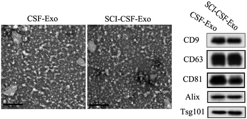 Figure 2. Biological characterization of exosome from CSF between SCI and normal. Exosomes exhibit a cup- or round-shaped morphology under ETM, with a size ranging from 50 to 80 nm. Meanwhile, these exosomes expressed exosomal surface marker proteins, including CD9, CD63, CD81, Alix and Tsg10.