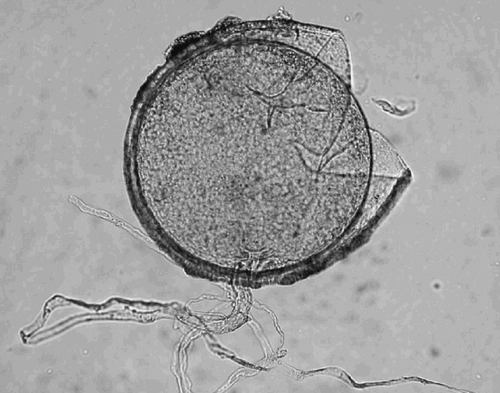 Fig. 4. Crushed spore of Glomus caledonium showing two of its four wall layers; a thin colourless outer layer and a yellow inner layer. The diameter was 307 μm. The subtending hypha was observed to have a ‘septum’ at the point of attachment, although not seen in this photograph.