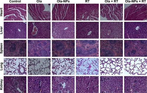 Figure 5 Evaluation of side effects: H&E staining of heart, liver, spleen, lung, and kidney of each group (magnification, ×200).Abbreviations: Ola, free olaparib; Ola-NPs, olaparib nanoparticles; RT, radiotherapy.