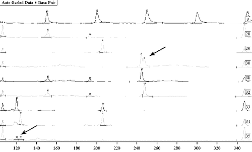 Figure 1. Mixed traces of semen from two men. Sample 3: Sizer 50–500. Samples 30, 31 and 32: a study on Y chromosome marker DYS392 with sequencing – semen on sports clothes and two suspects. Samples 33 and 34: a study on Y chromosome markers DYS393 and DYS390 with sequencing – two suspects, and sample 35: mixed semen from two men on physical evidence. Samples 30 and 35: mixed biological material where differentiation of the DNA profiles of the two persons was possible.