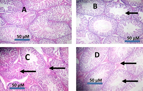 Figure 6. Representative photomicrographs of testes from control and NDMA-treated rats. Control testes (A) showed normal morphology. Treatment-related lesions such as mild congestion, degeneration of the seminiferous tubules and distortion in the testes of NDMA-treated rats (C) were reduced in [NDMA+BA]-treated rats (D), while photomicrographs from BA-treated rats (B) appeared similar to the control (A). BA: betulinic acid; NDMA: N-nitrosodimethylamine.