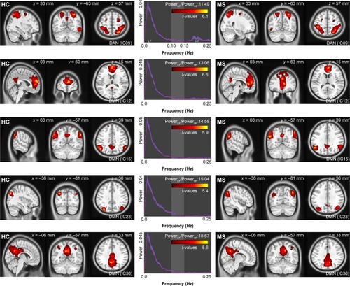 Figure 1 DMN and DAN of remitting-phase RRMS patients (right column) and HCs (left column) (one-sample t-test, p < 0.05, Bonferroni corrected). ICx: independent component x obtained by group ICA.